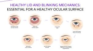 Diagram showing blinking process and eye health, from irritation to healthy blink.