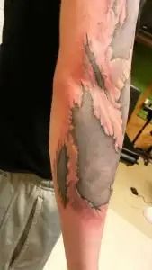 Arm with large gray skin patch and peeling pink skin, suggesting a burn or healing wound