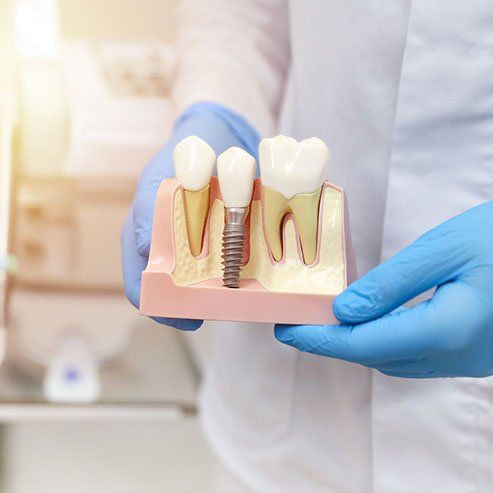 Dental crown on an artificial jaw