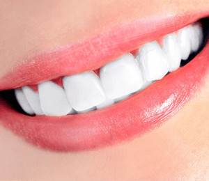 pearly white teeth