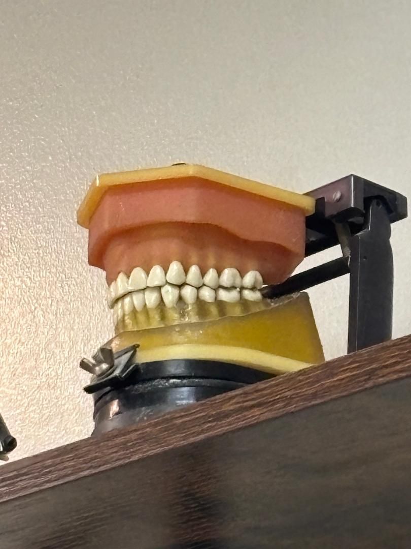 A dental model of upper and lower teeth mounted on a metal articulator, set on a wooden surface against a light wall.