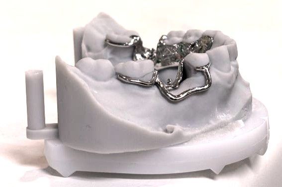 A metal dental partial frame denture framework fitted onto a 3D-printed model of a lower jaw.
