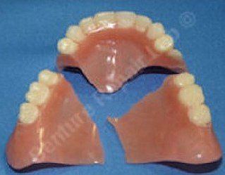 Same-Day Denture Repairs