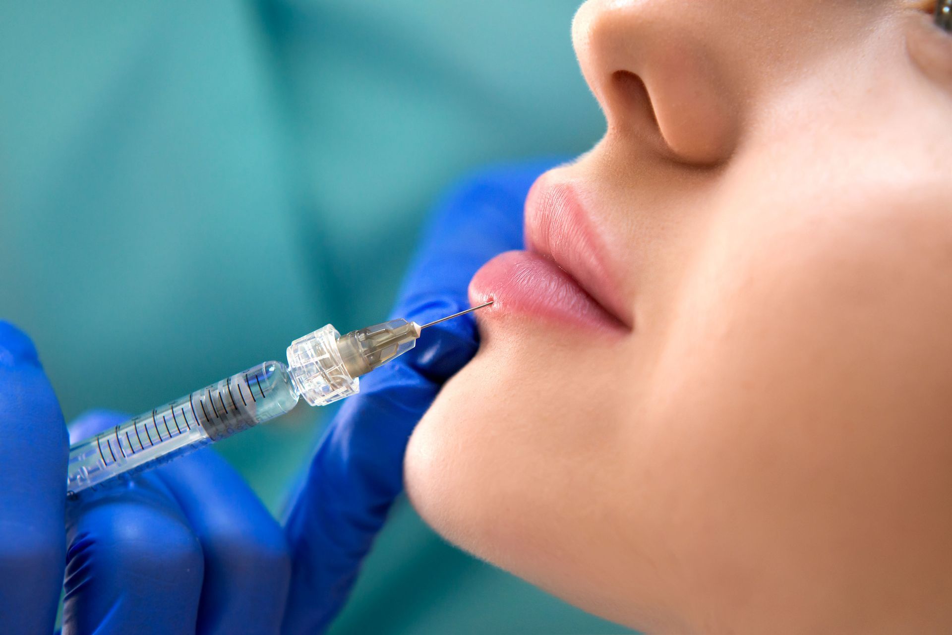 client receiving lip injections