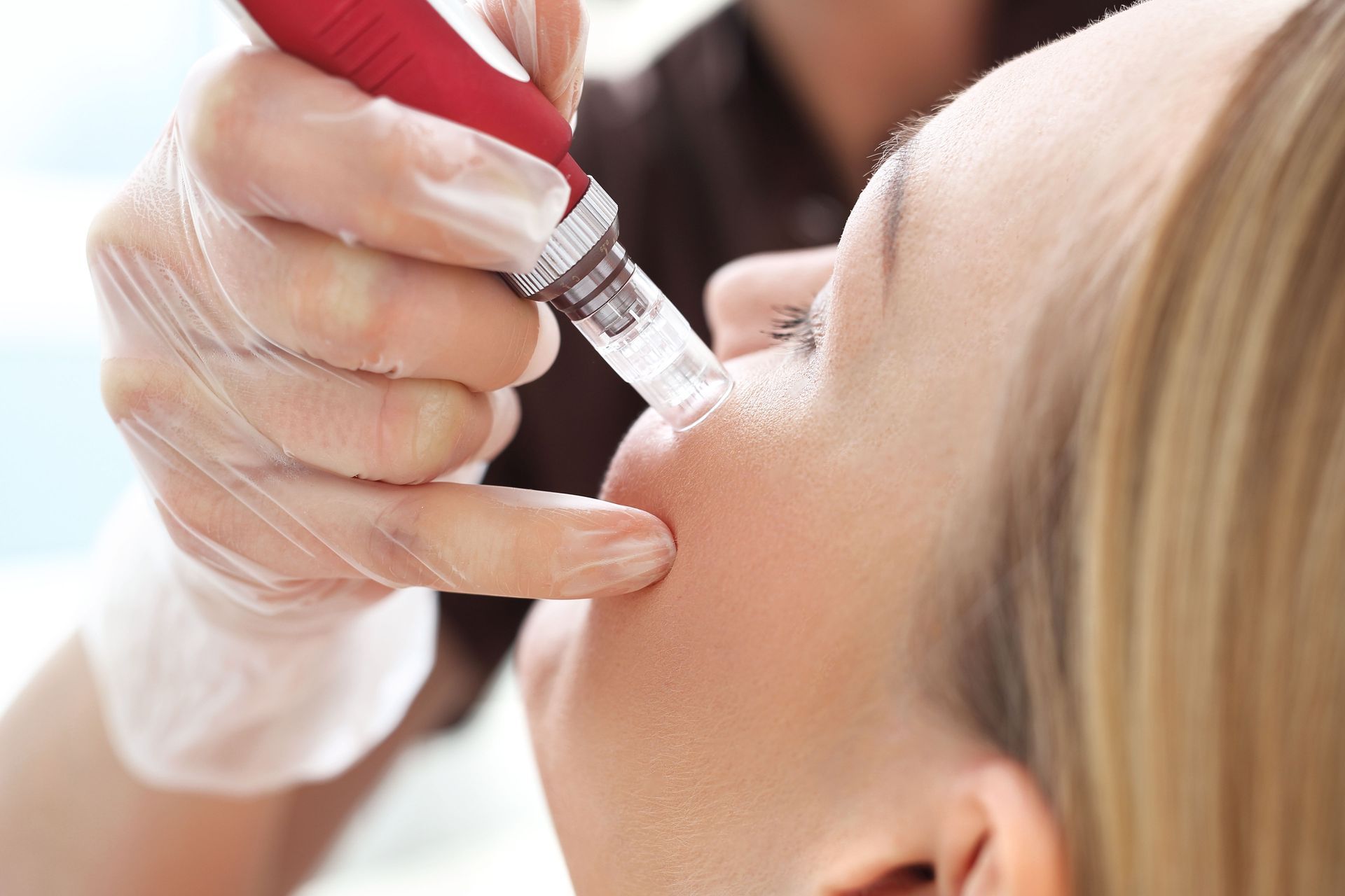 woman receiving microneedling service