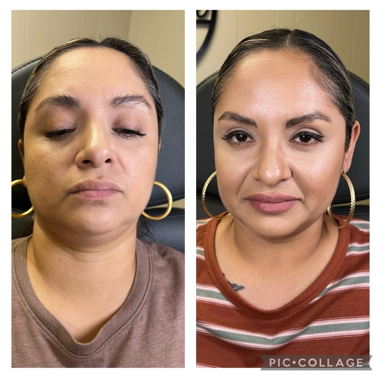 A before and after photo of a woman 's face