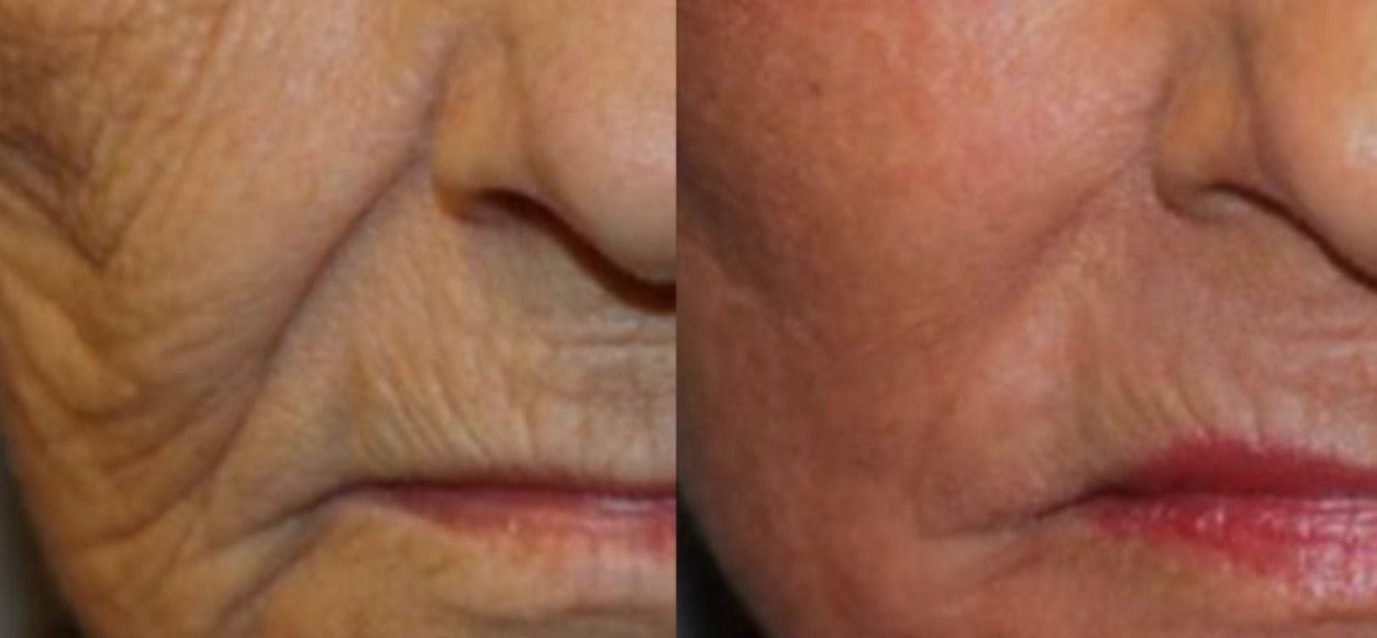 Before and after photo