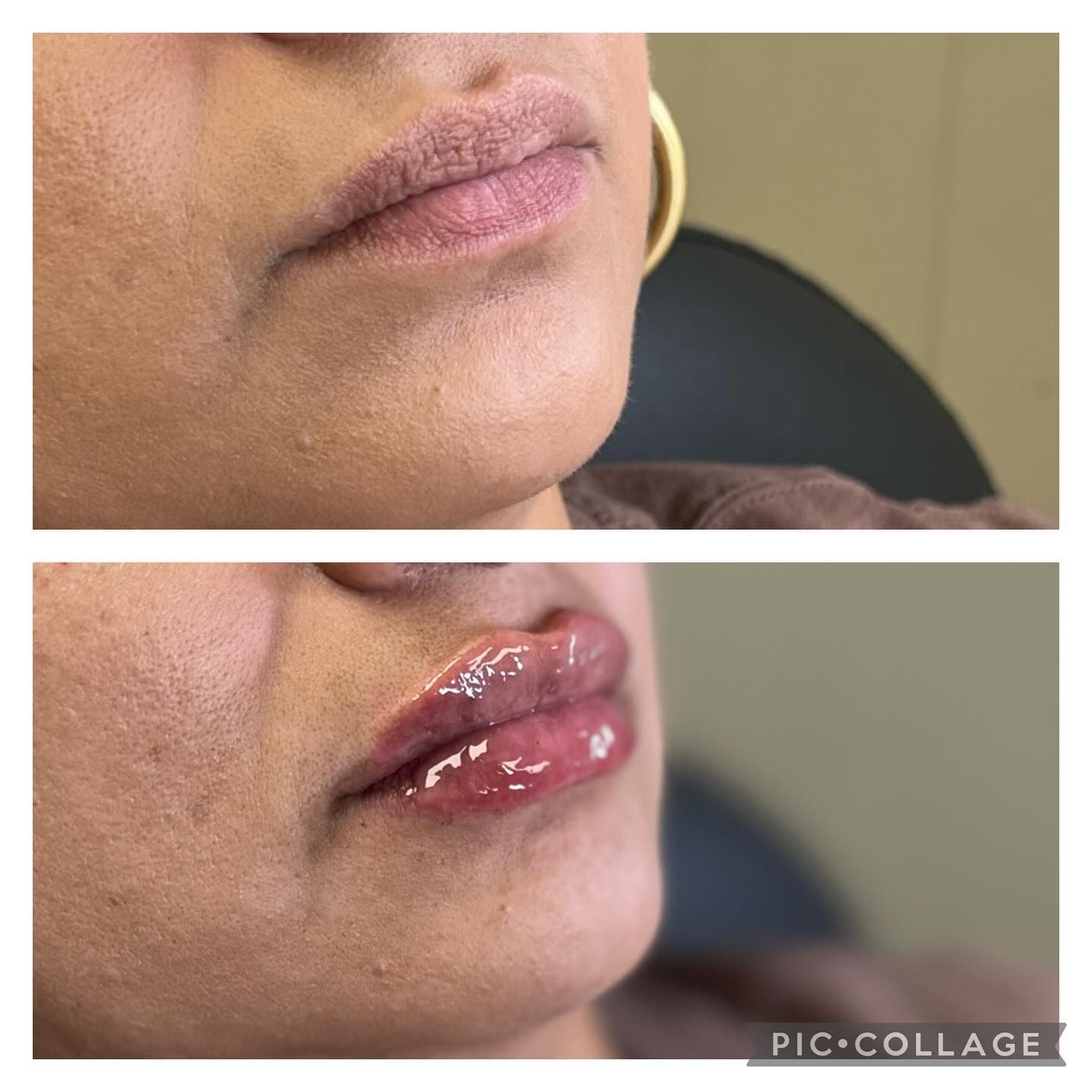 A before and after photo of a woman 's lips.