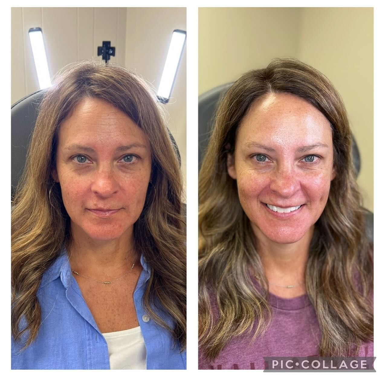 A before and after photo of a woman 's face