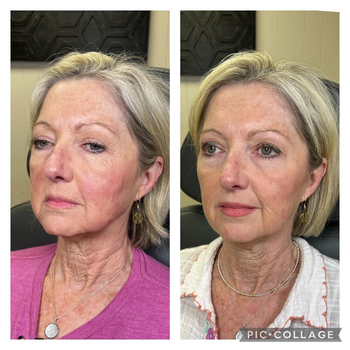 A before and after photo of a woman 's face.