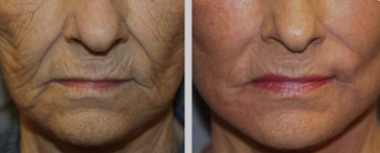 Before and after photo