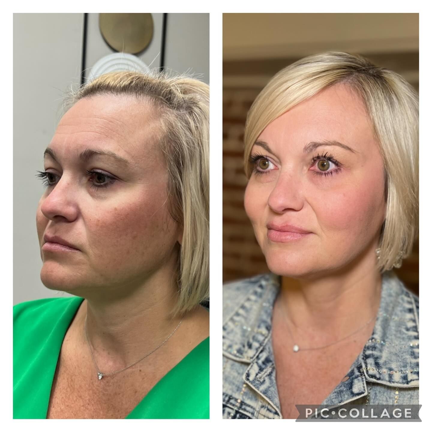 A before and after photo of a woman 's face.