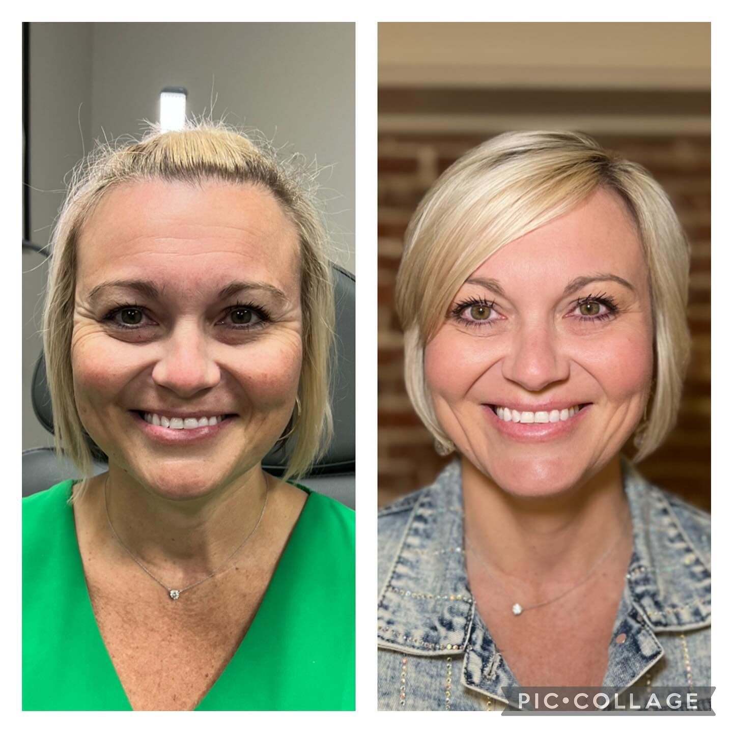 A before and after photo of a woman 's face