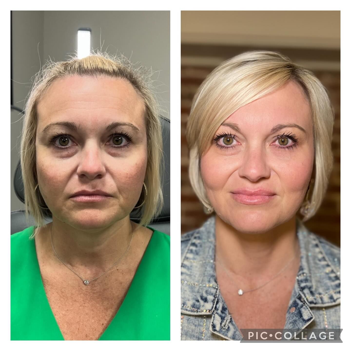 A before and after photo of a woman 's face.