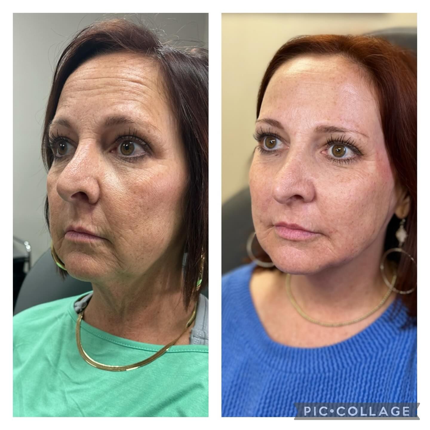 A before and after photo of a woman 's face.