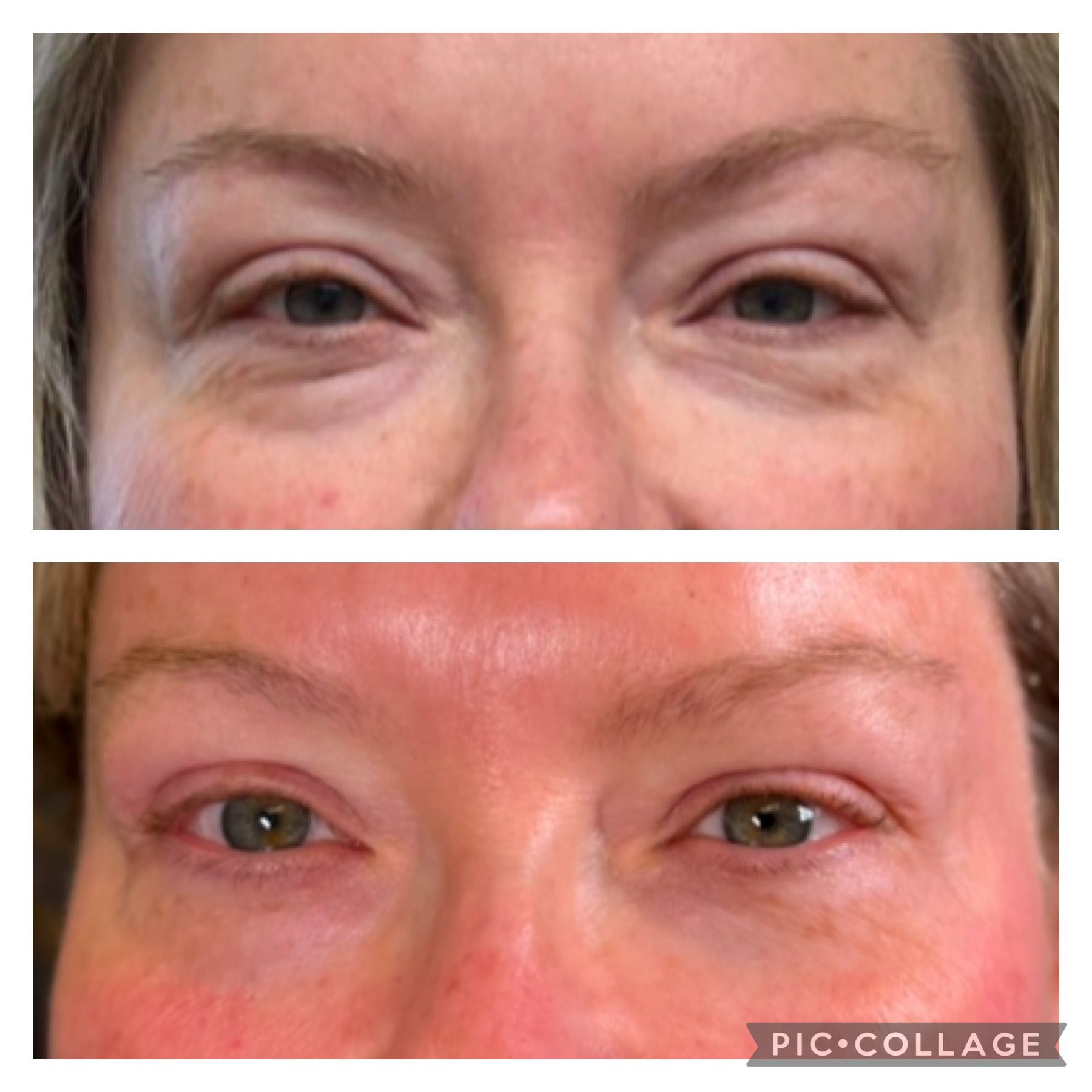 A before and after photo of a woman 's eyes