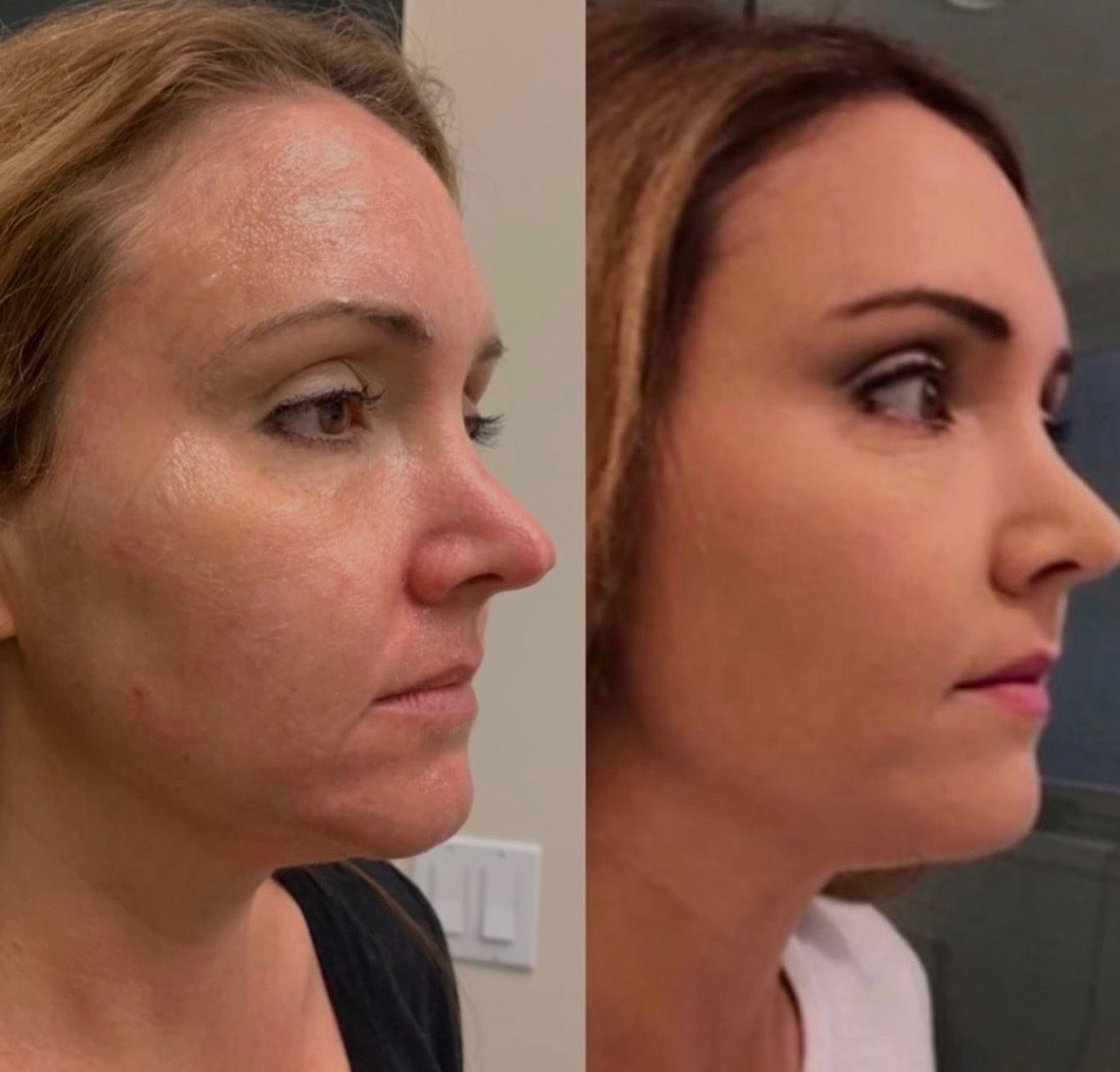 Before and after photo