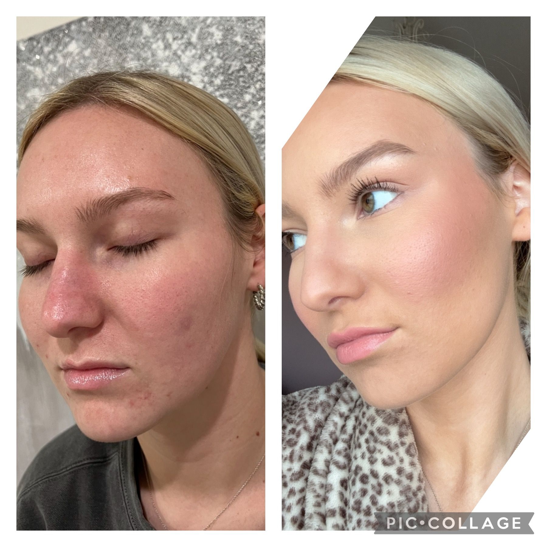 A before and after photo of a woman 's face