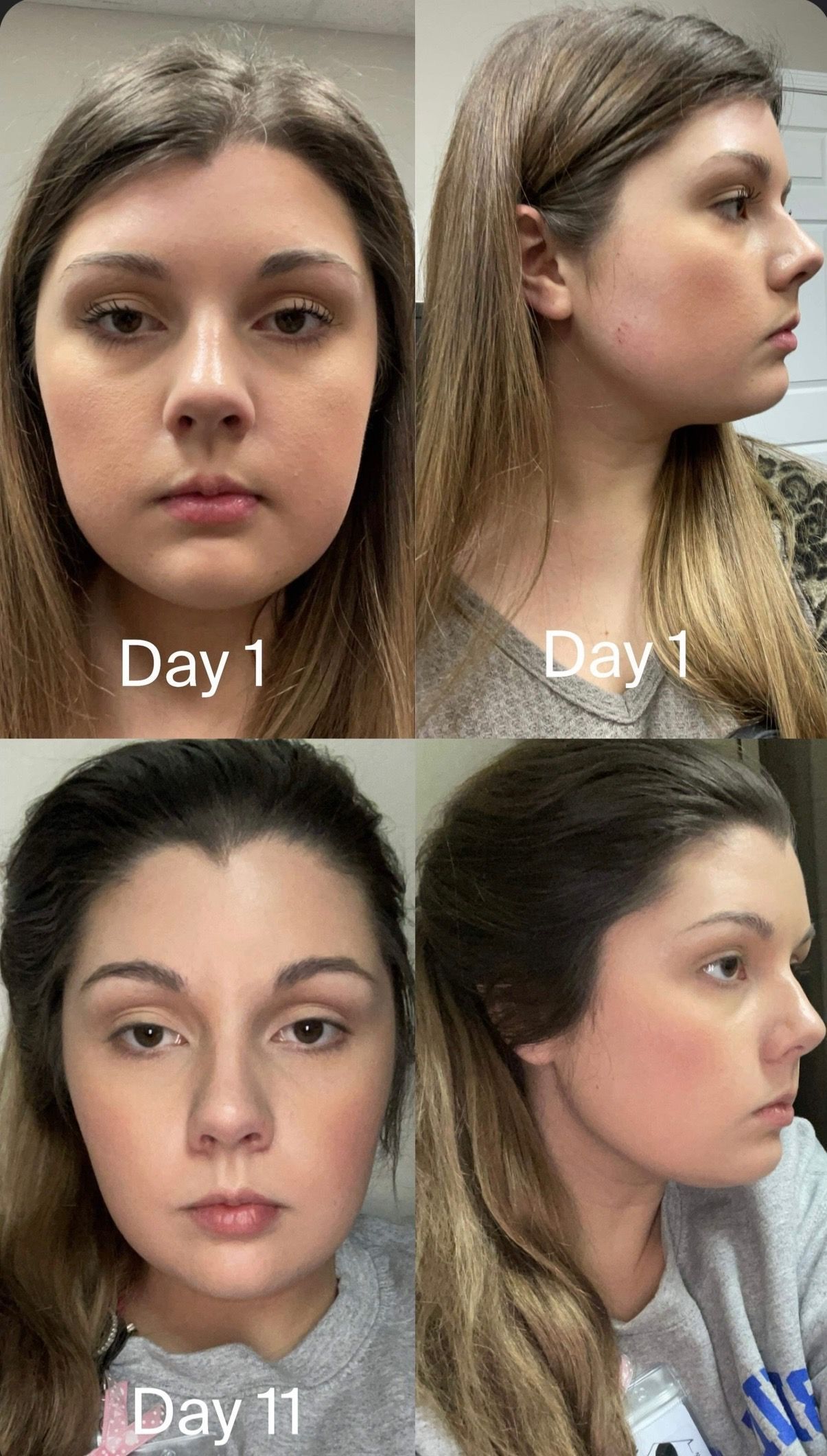 A collage of four pictures of a woman 's face.