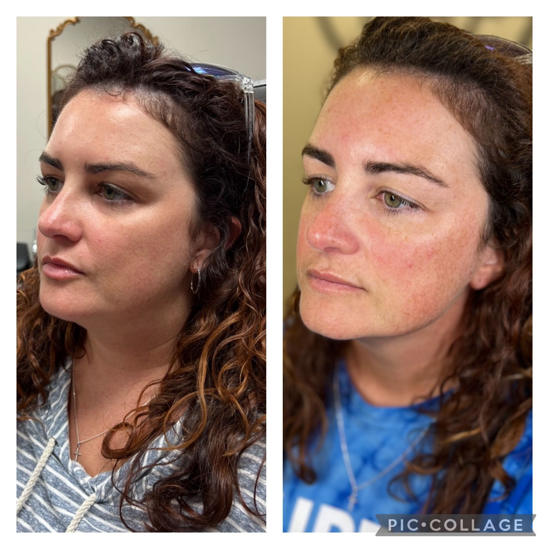 A before and after photo of a woman 's face