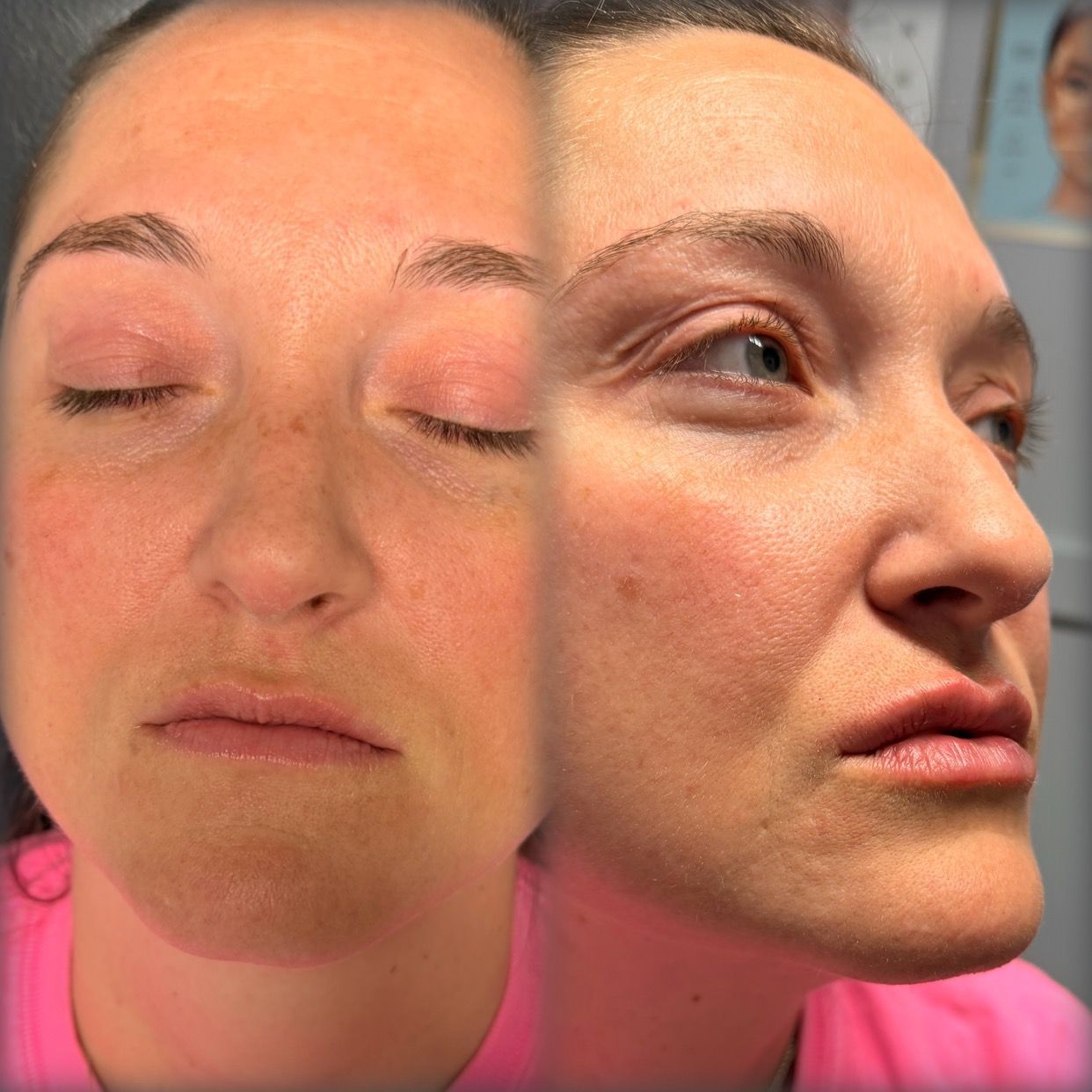 Side-by-side close-ups of a woman’s face, eyes closed on the left and profile on the right.