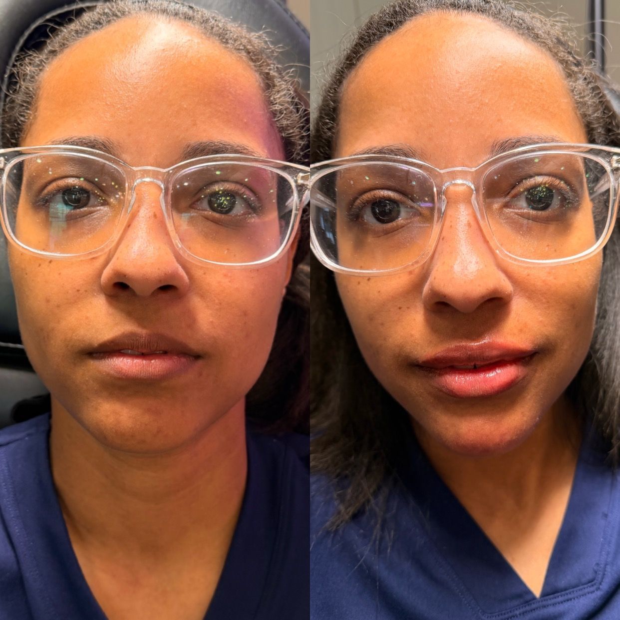 Side-by-side close-up portraits of the same person wearing clear glasses and navy scrubs, neutral expression.