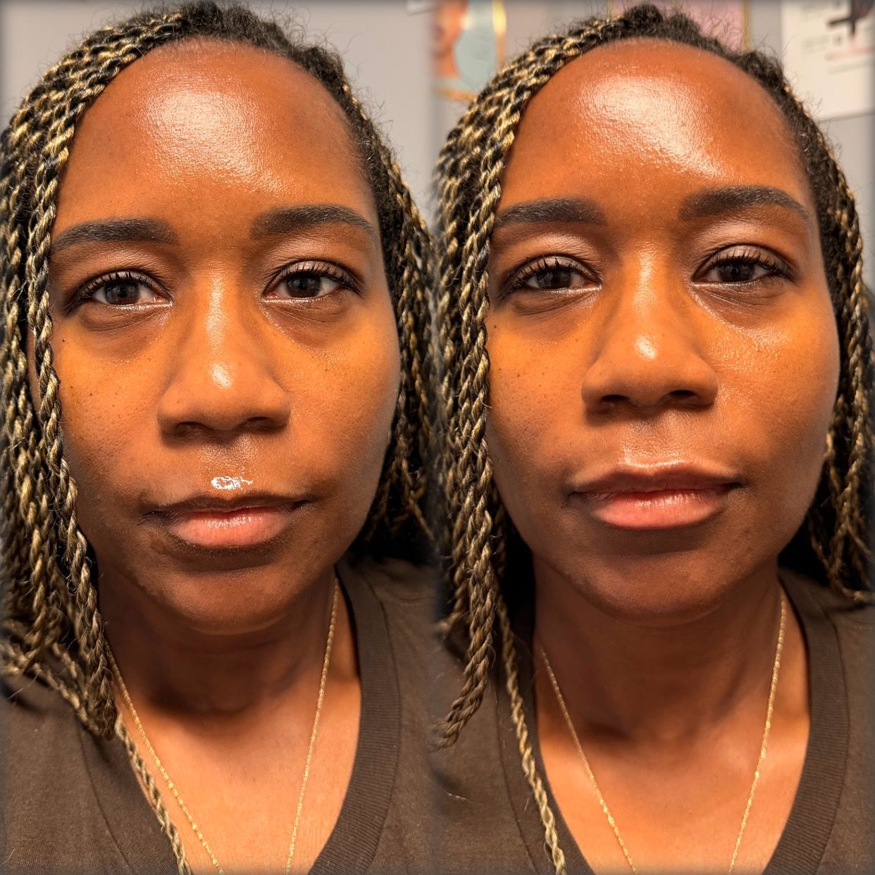 Side-by-side close-up portrait of the same person with a neutral expression in warm indoor light