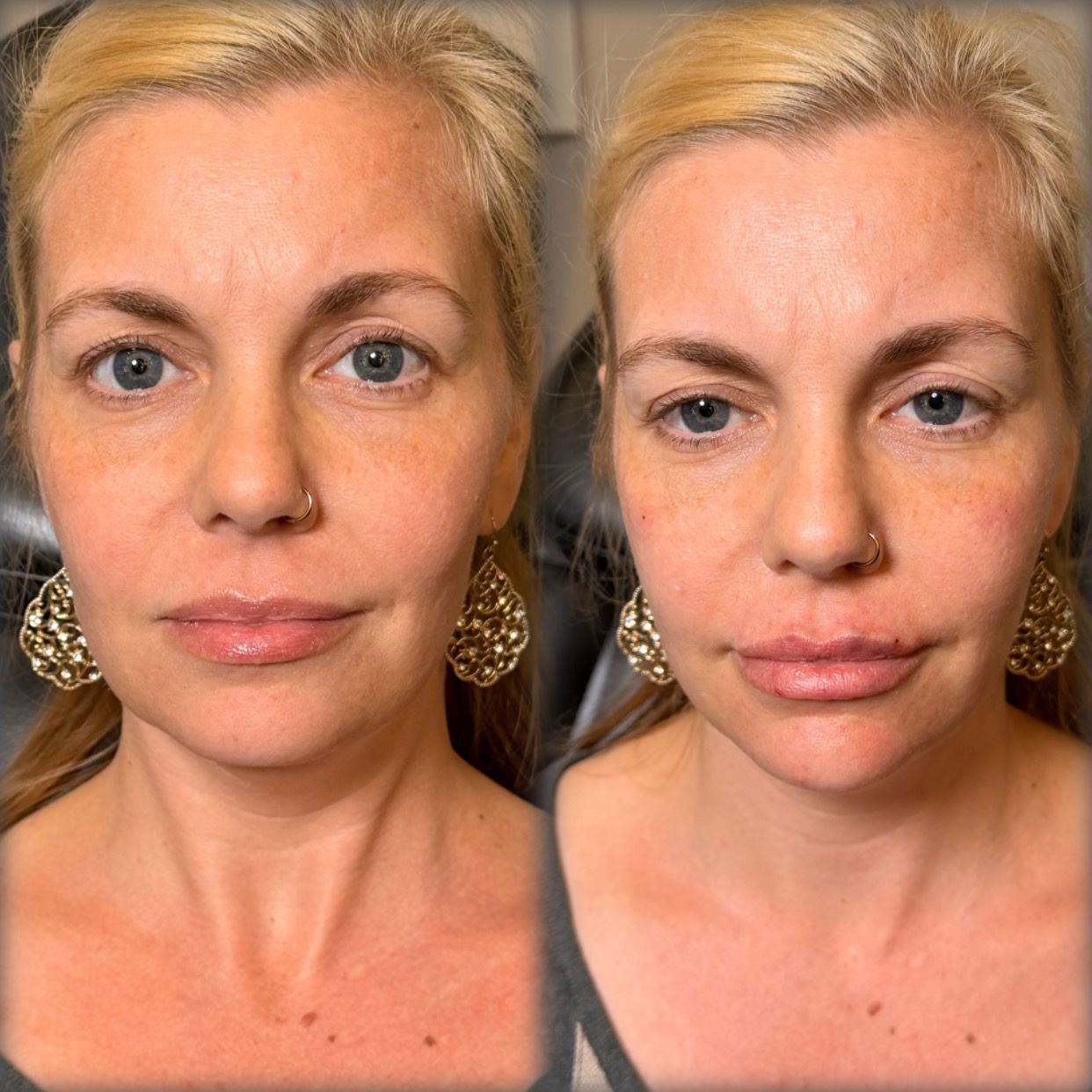 Side-by-side portraits of the same woman, showing a neutral face and a slight smile against a plain background.
