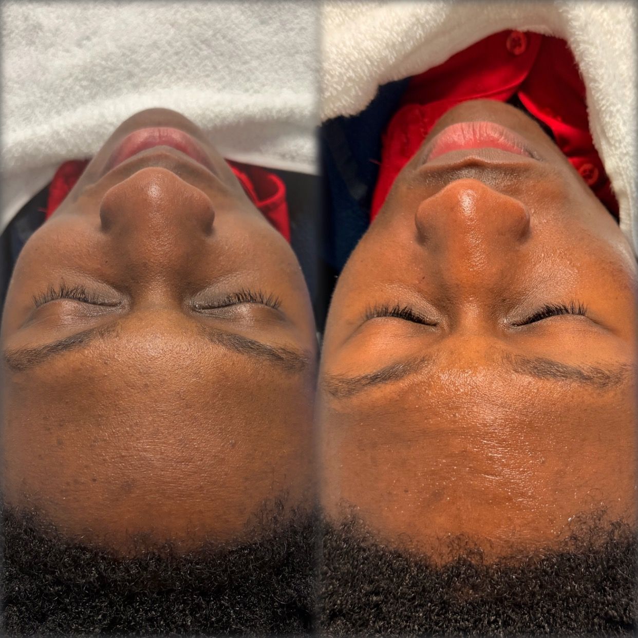 Close-up of a person lying down with eyes closed, shown in two side-by-side views with different lighting.