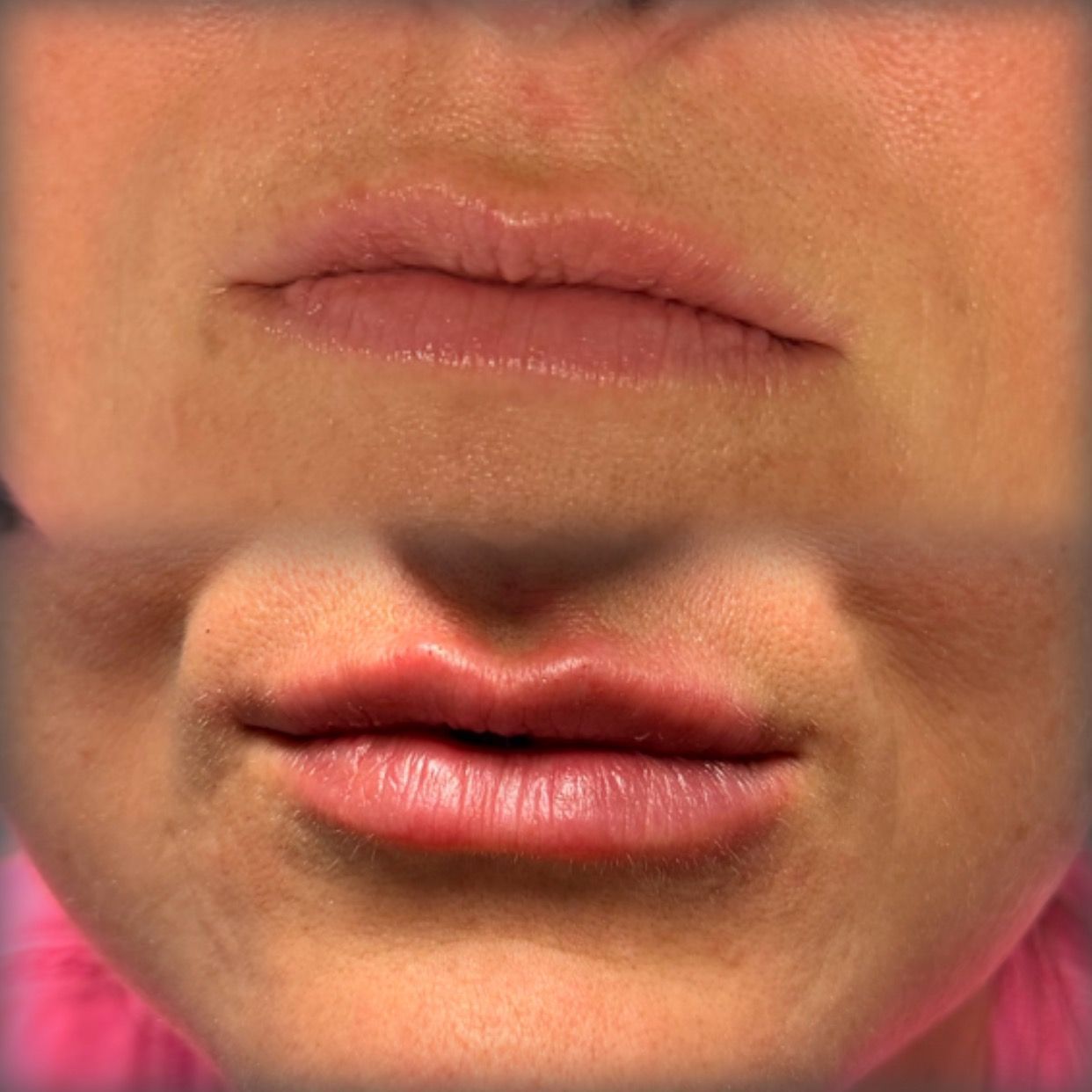 Close-up of two lips, one natural and one glossy pink, stacked vertically.