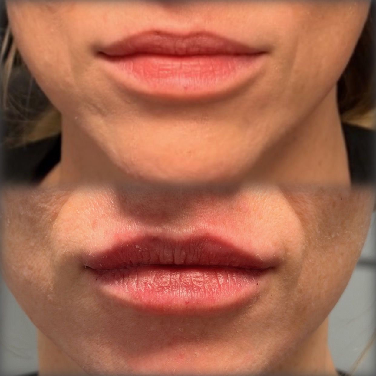 Split close-up of lips: lighter lips on top, darker reddish lips on bottom