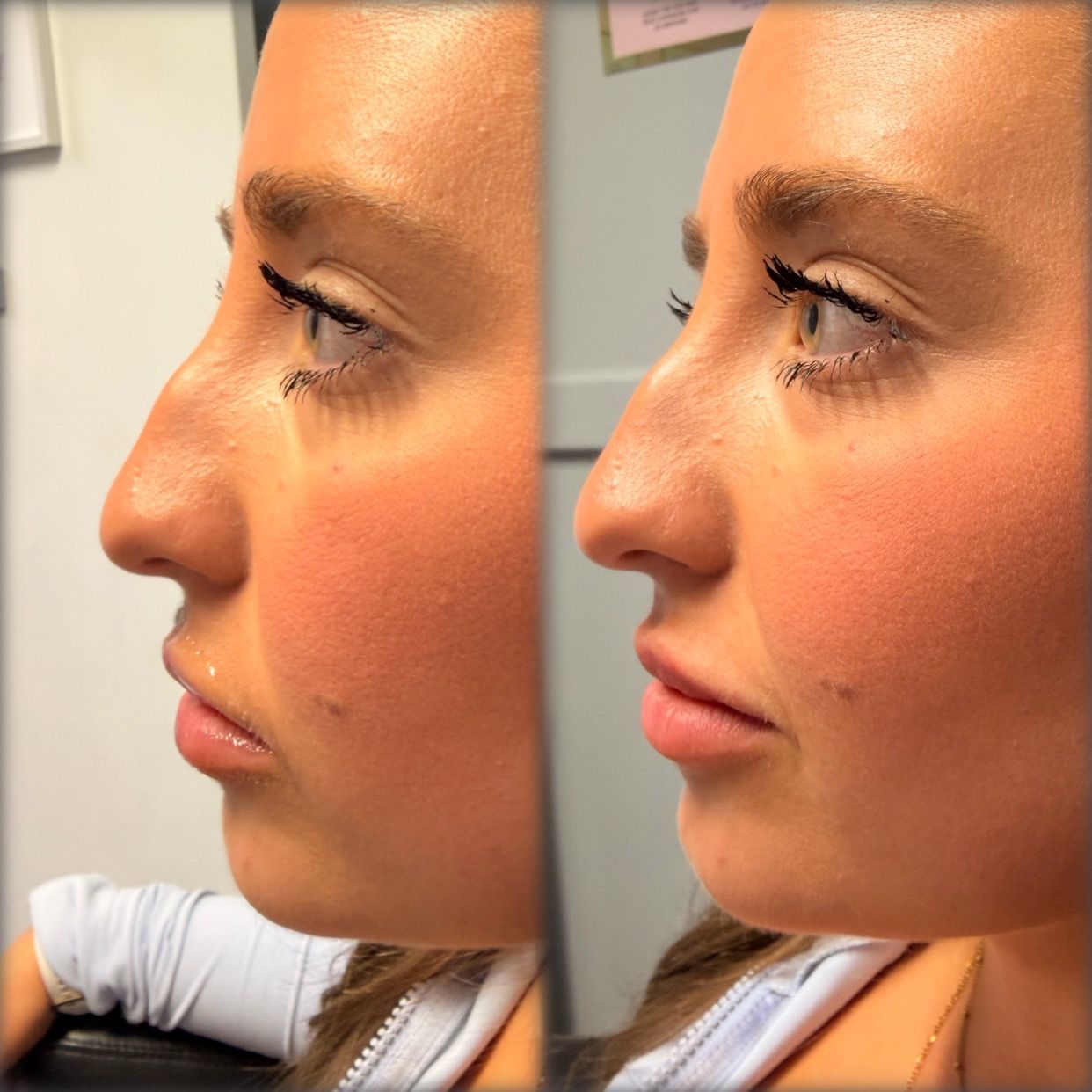 Side-by-side profile close-up of a woman’s face before and after makeup, warm indoor lighting