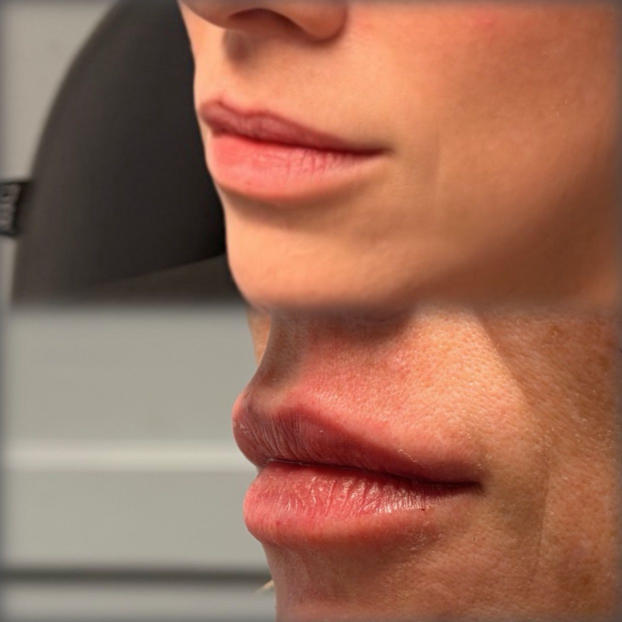 Close-up side profiles of two faces, focusing on lips and nose, in warm indoor light.
