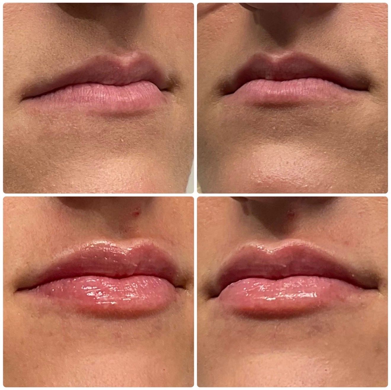 Four close-up shots of lips before and after lip gloss application, showing a shinier finish.