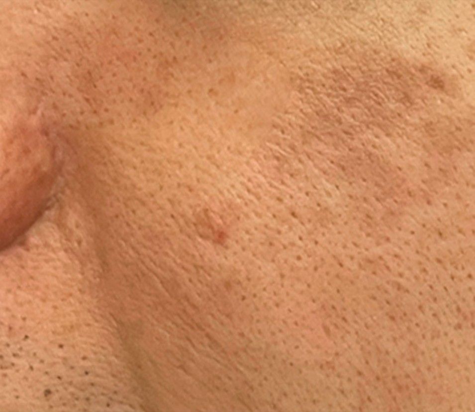 Close-up of peach-colored skin with visible pores and fine hair.