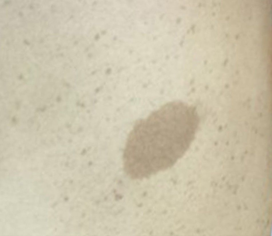 Small brown oval stain on a light speckled surface