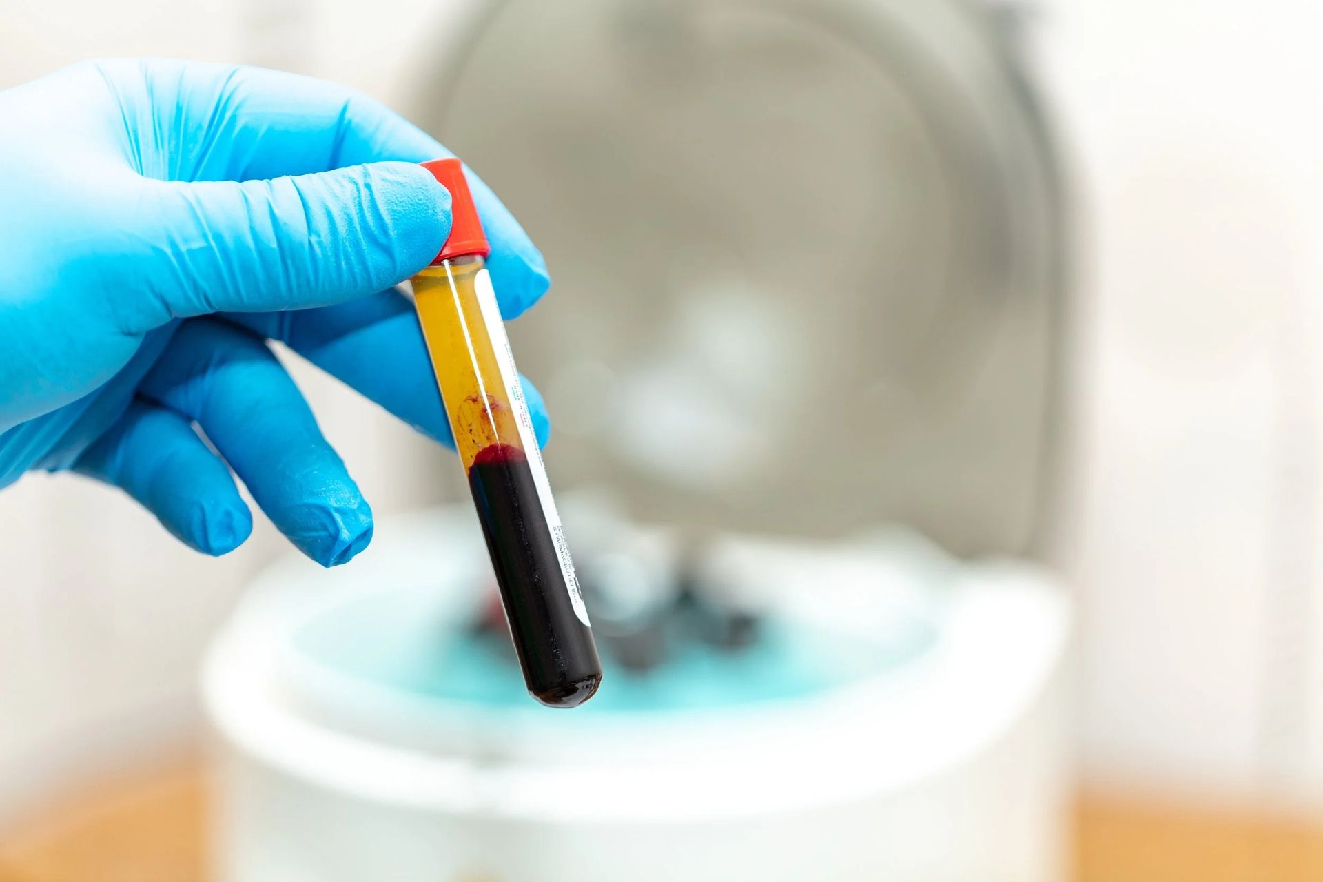 Gloved hand holding blood sample tube, separated into red and yellow layers, with a centrifuge in the background.