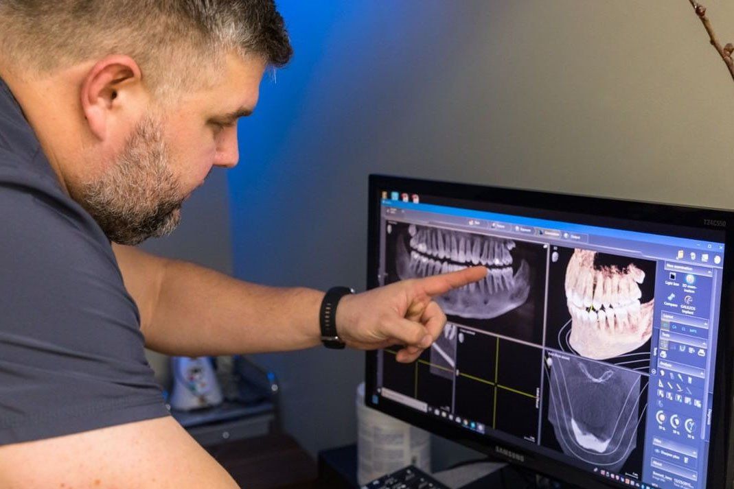 A man is pointing at an x-ray of his teeth on a computer screen