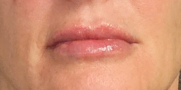 A close-up of a person's mouth with natural-toned lips and skin, centered in the frame.