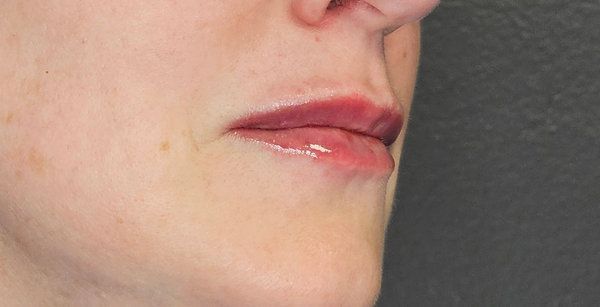 A close-up view of a person's mouth with subtle, natural-toned lip makeup, viewed from a slight angle.