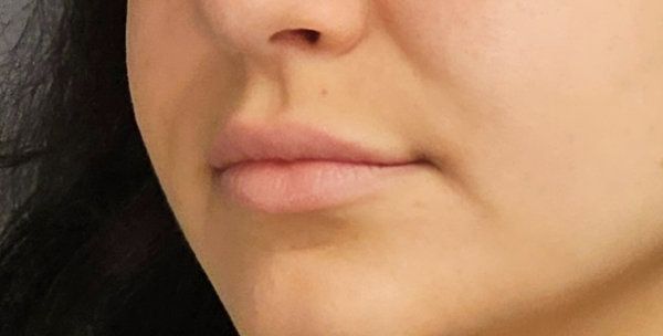 A close-up view of a person's mouth and nose area, showing natural, fair-toned skin and lips in a neutral expression.