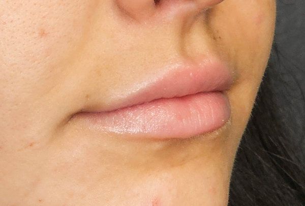 Close-up of a person's mouth and lips, showing their natural shape and texture in neutral lighting.