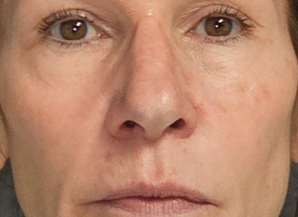 Close-up, front-facing view of a person's face from the eyes to the mouth with a neutral expression.