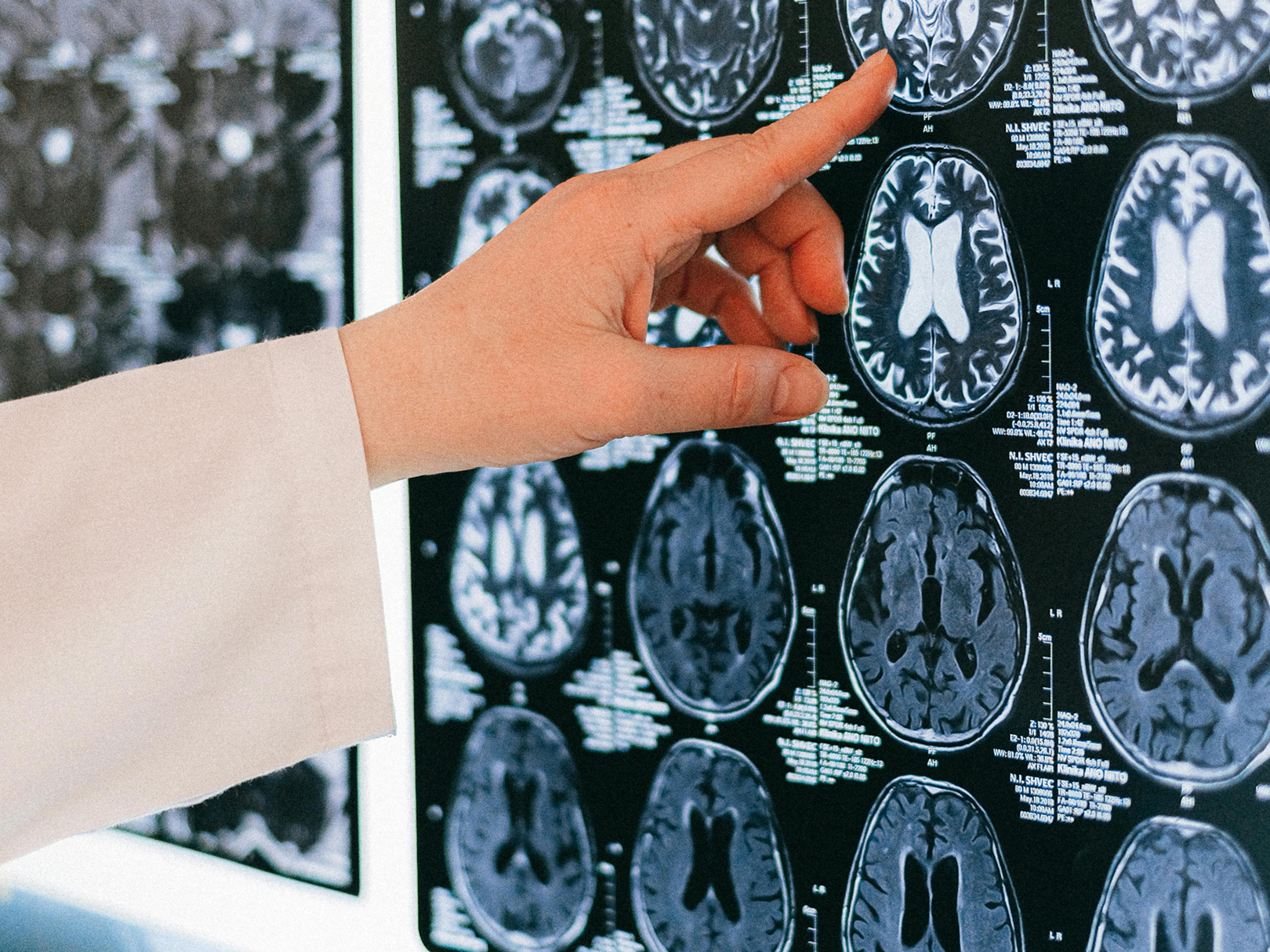 A person is pointing at an x-ray of a brain