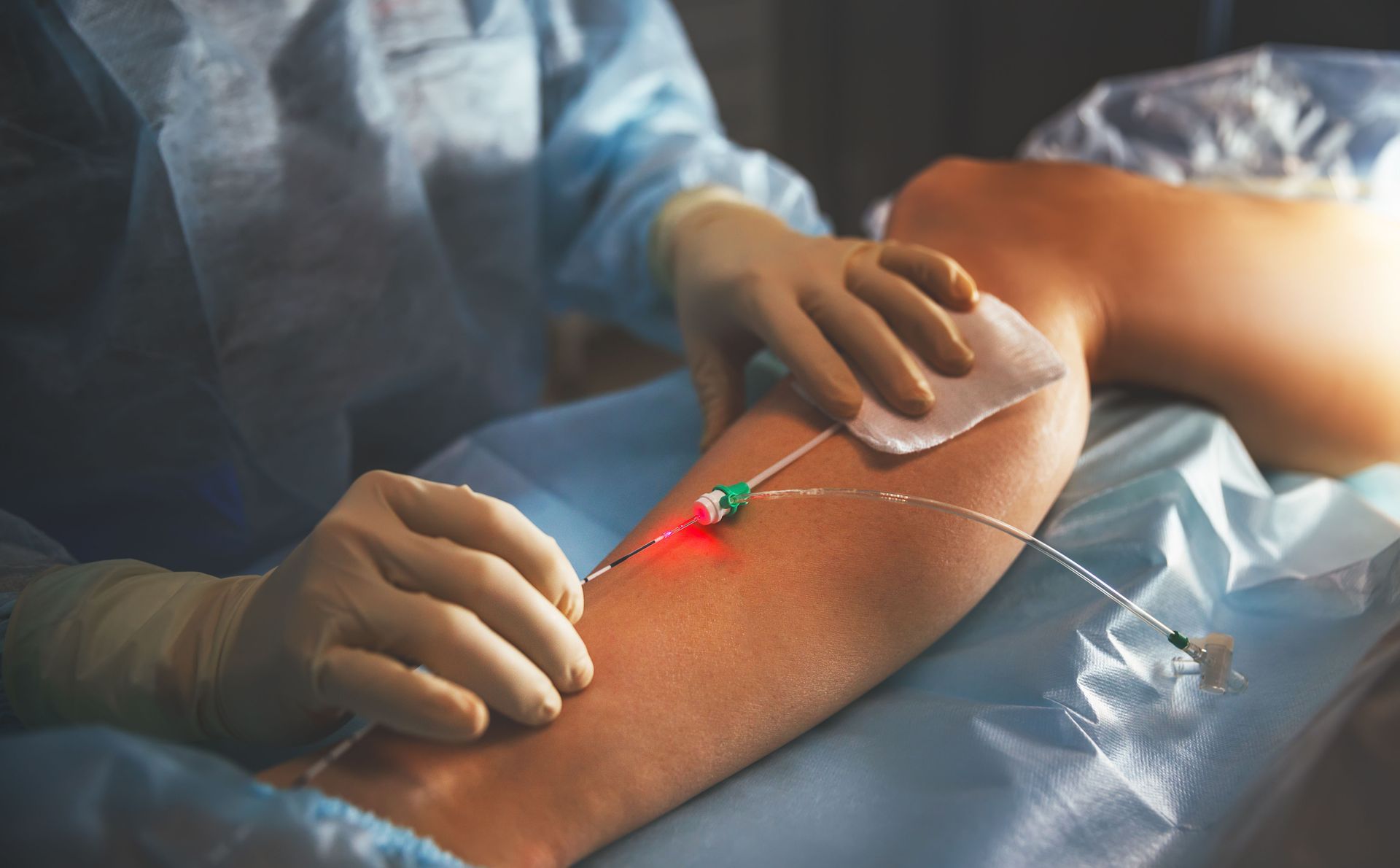 varicose vein specialist