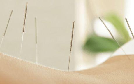 medical acupuncture