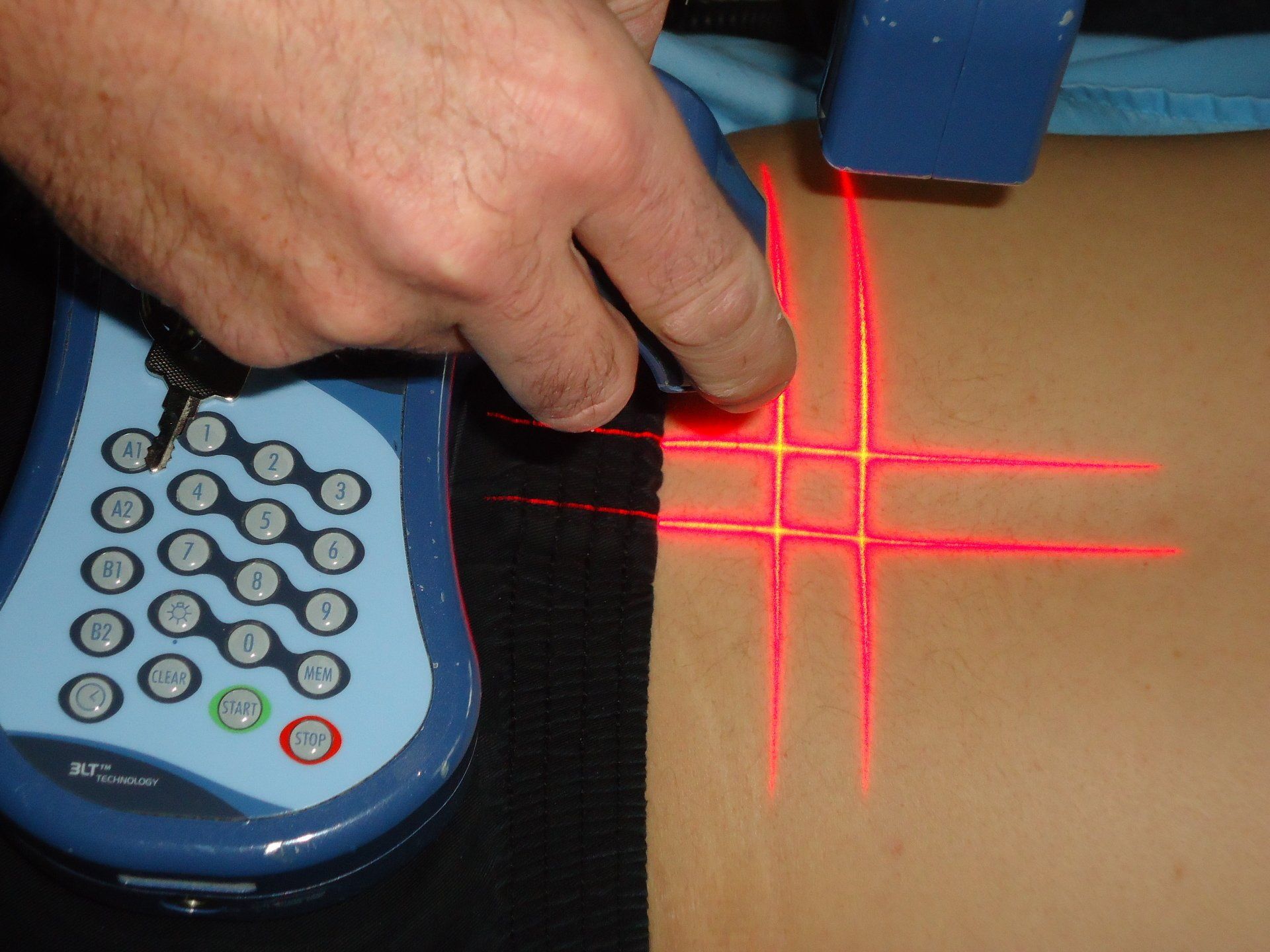 Low-Level Laser Therapy