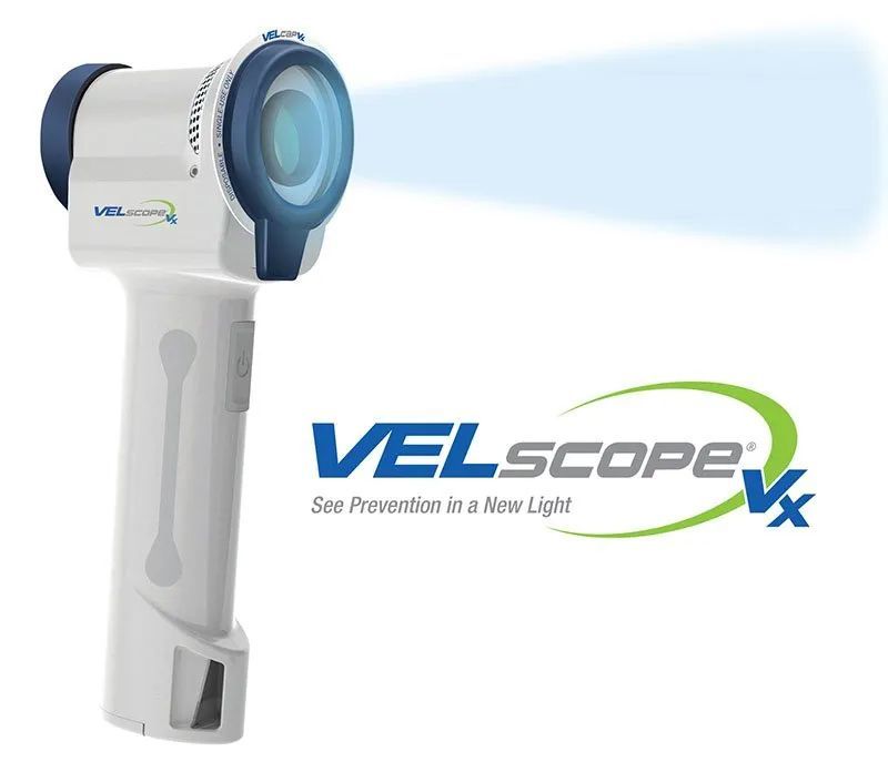 VELscope Vx