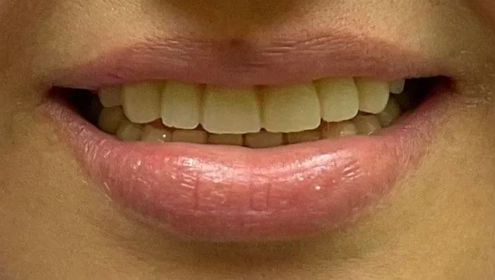 Close-up of a smiling mouth, showing teeth and pink, slightly parted lips.