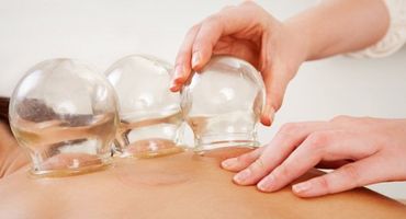 Suction cupping service
